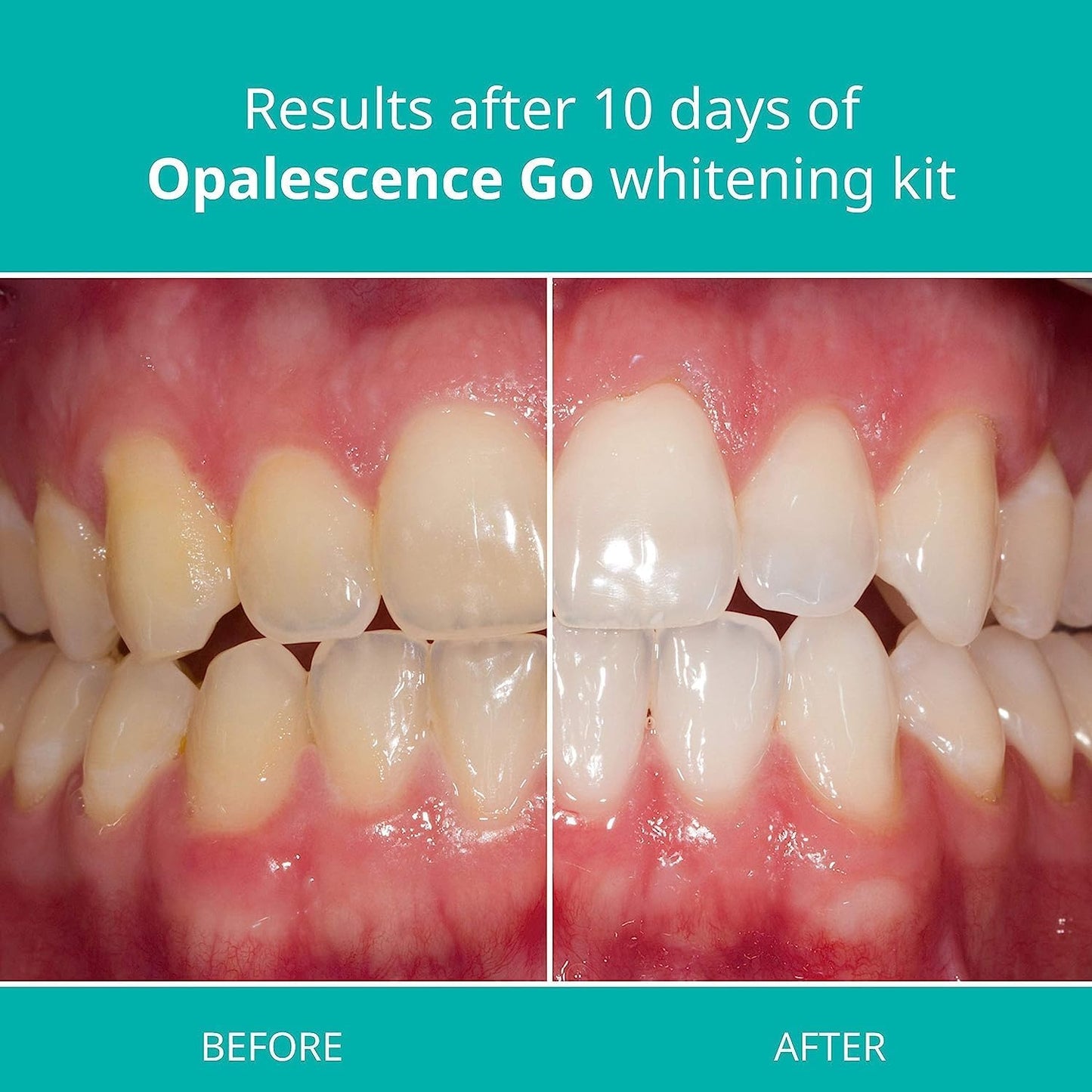 Opalescence Go balinimo kapos 6%, 10vnt